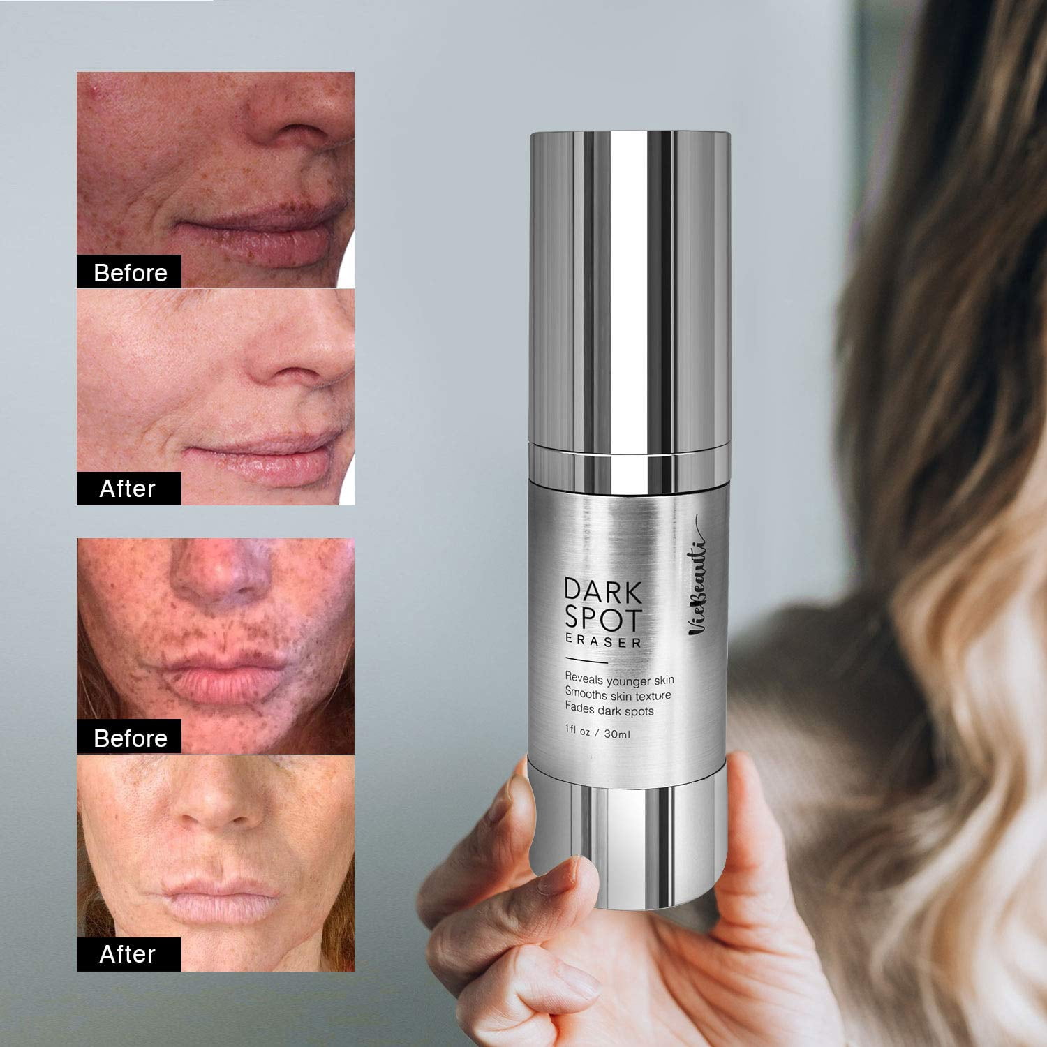viebeauti dark spot corrector remover