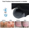 thumbnail image 6 of 1 Pair Moisturizing Gloves+1 Pair Moisturizing Socks, Gel Gloves and Gel Socks for Dry Cracked Heels &Hands Treatment,Spa Gloves and Spa Socks for heal dry cracked feet(Black), 6 of 7