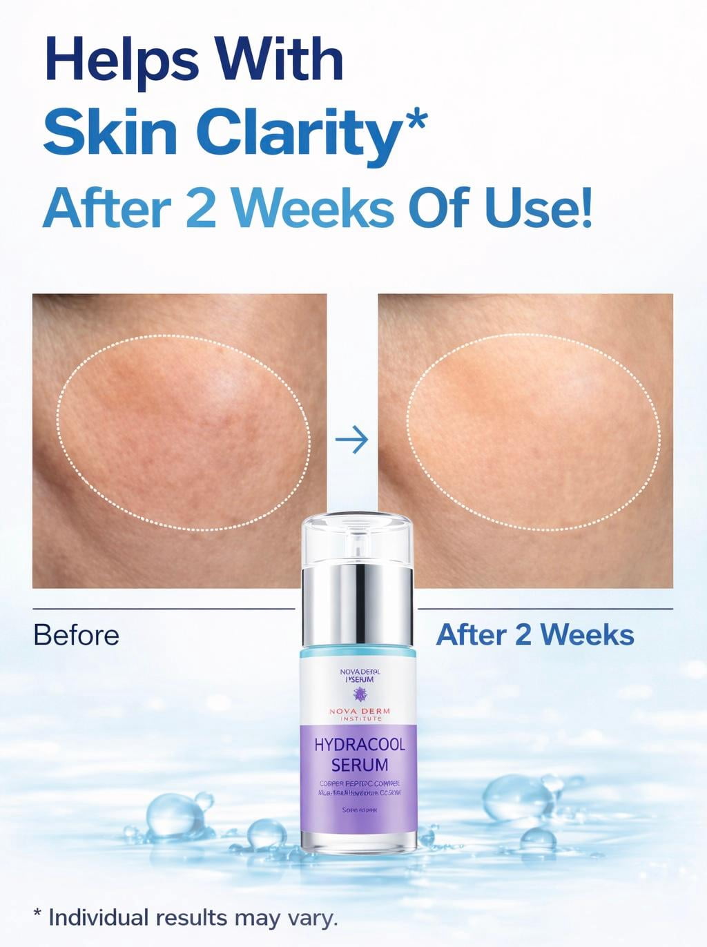 Nova Derm Institute Hydrating Hyaluronic Acid Serum with 20% HA for Dry & Sensitive skin Types, Copper Peptides for Anti Aging, Non Comedogenic 1 fl oz