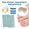 thumbnail image 3 of Titanium Ingrown Toenail Corrector Kit - Professional Pedicure Tools, 3 of 8