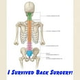 thumbnail image 3 of CafePress - I Survived Back Surgery! Light T Shirt - Men's Classic Graphic T-Shirt, 3 of 4