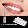 thumbnail image 3 of Yeacher 10 Pcs P1 Scaler Handpiece Scaling Tips Handpiece Fit for Woodpecker, 3 of 3