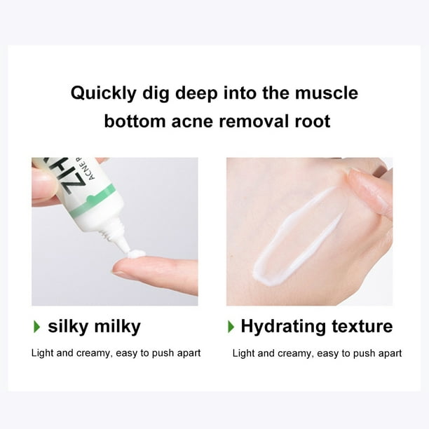 Zhen Xiu Salicylic Acid Repairing Acne Cream Herbal Acne Cream To Dilute  Acne