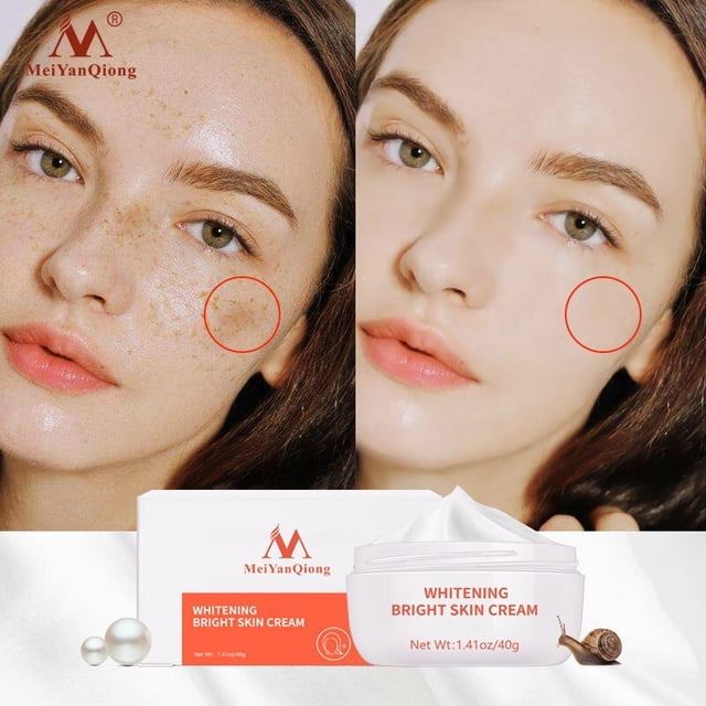 Crema blanqueadora de piel para mujer, emulsión de melanina que ilumina la parte interna del muslo, blanquea los glúteos y las rodillas, partes privadas, suero blanqueador de axilas"2 bottles" Fivean LED