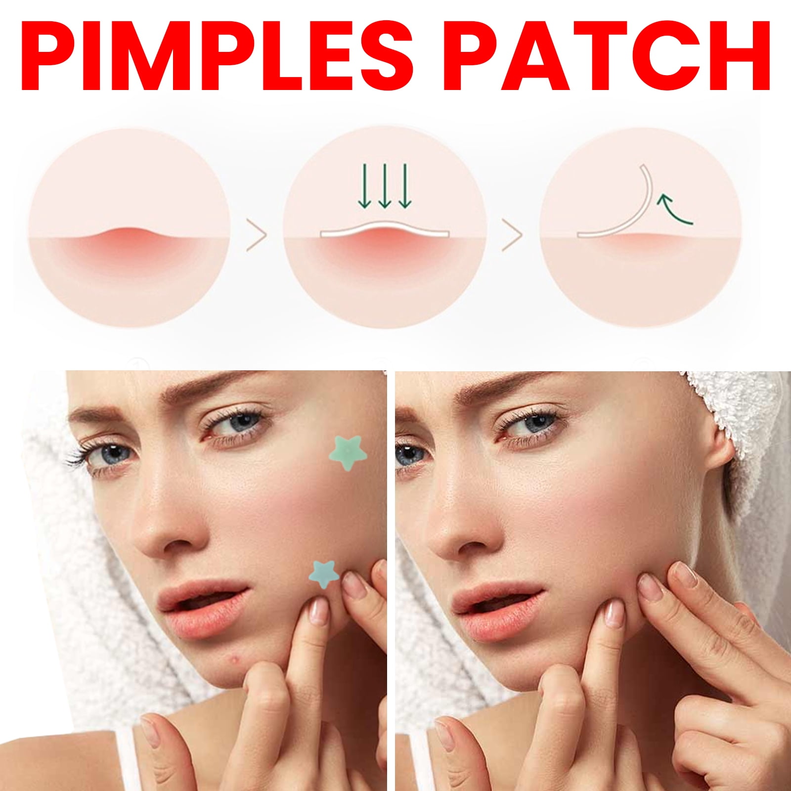 Alvantor Pimple Patches with Tea Tree Hydrocolloid Acne, Star Zit Covers, 200 Count