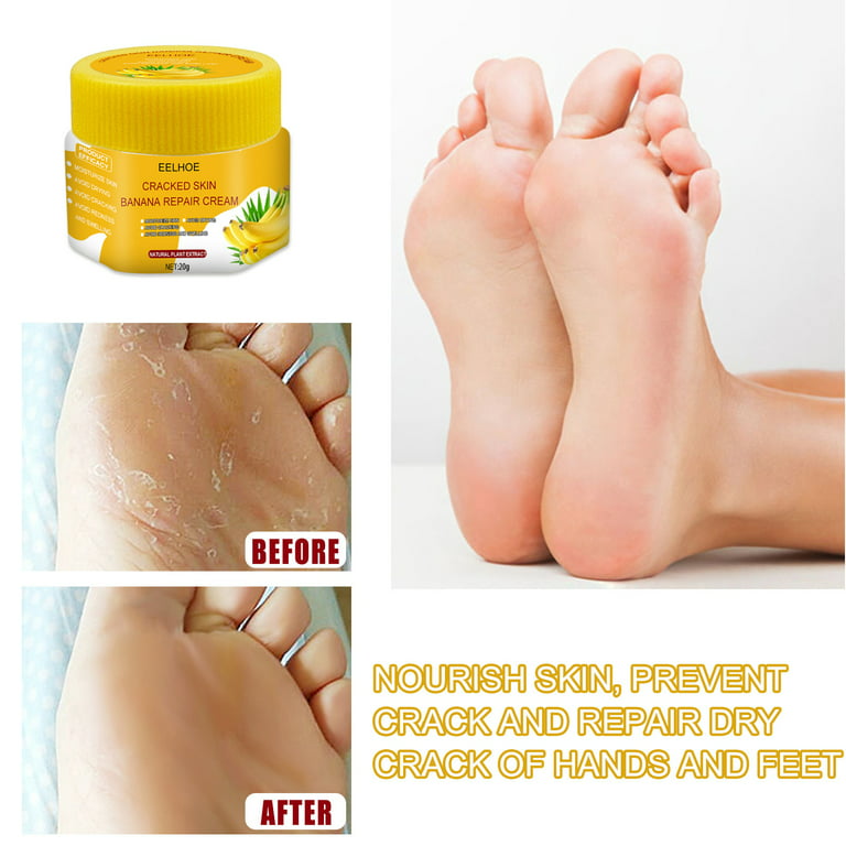 20g foot Dead Skin Remover banana oil Anti-drying crack foot cream cracked  heel repair hand