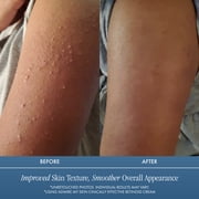 Admire My Skin Retinol + Vitamin C Hydrating Face Cream Moisturizer – Daily Skincare Treatment