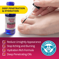 thumbnail image 6 of Better Nail – Anti Fungus Treatment for under and around Fingernails & Toenails, Restores & Supports, 6 of 7