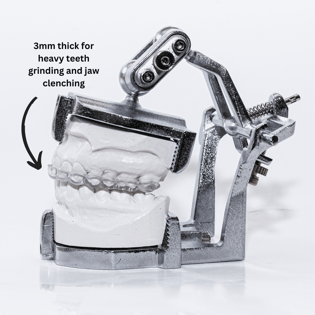 Sentinel Mouthguards® Durability Mouth Guard for Heavy Teeth Grinding and Clenching