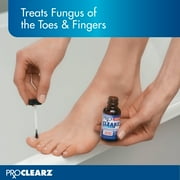 Pro Clearz Fungal Shield Brush-On Antifungal Liquid, Maximum Strength 1 oz (Pack of 2)