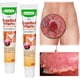 thumbnail image 2 of Ungüento de 20g JM para eliminar verrugas genitales y etiquetas de piel botella portátil, 2 of 6