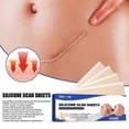 thumbnail image 3 of Parche de silicona autoadhesivo para cicatrices, repara cicatrices de quemaduras y suaviza la piel, parche para el cuidado de los traumatismos cutáneos-4065513349684, 3 of 5