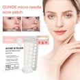 thumbnail image 2 of Parches para el acné Parches transparentes para el acné que impiden que el maquillaje se vea Parche para el acné hidratante resistente al agua para cerrar el acné y desvanecer las Autorización, 2 of 9