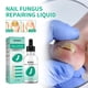 thumbnail image 3 of 30ml Toenail Fungus Oil Nail Care Repair Liquid para blanqueamiento antihongos Ndcxsfigh  Nuevos Originales, 3 of 9