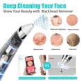 thumbnail image 2 of Blackhead Remover Pore Vacuum with Camera, Facial Pore Cleaner, Electric Acne Comedone Whitehead Blackhead Extractor with 4 Rubber Probes, Visible HD Pore Vacuum Remover, 2 of 7
