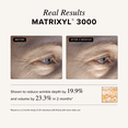 thumbnail image 5 of Asterwood Triple Repair Matrixyl 3000 + Argireline + Hyaluronic Acid + Vitamin C Serum for Face - Anti-Aging, Collagen Boosting, Hydrating - Fragrance-Free - 8 Fl Oz, 5 of 7