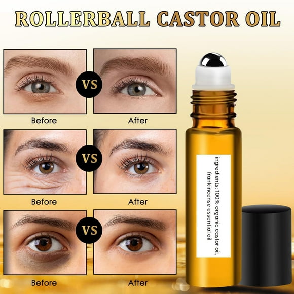 My Order Naittoop Roll- Castor Oil and Eye Oil Eraser Under Eye Rollerball Eraser Rollerball Oil Eraser Rollerball for Eyes 10ml