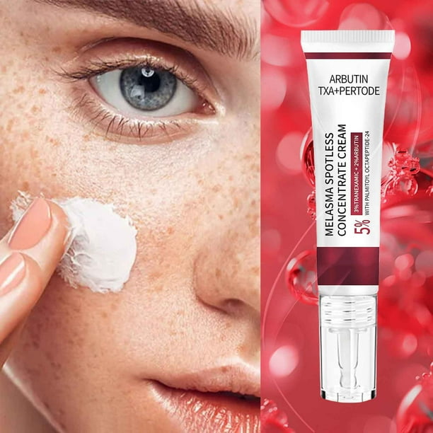Cremas e hidratantes Arbutina Crema concentrada antimanchas para el melasma - Crema blanqueadora Crema para eliminar manchas Crema para atenuar las pecas Crema para atenuar las manchas de cloasma y pe