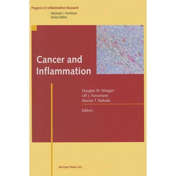 Progress in Inflammation Research Cancer and Inflammation, (Paperback)