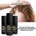 thumbnail image 4 of HaloGrow u200bu200bHair Growth Spray with Biotin & Caffeine - Fast-Acting Hair Regrowth Treatment for Thinning Hair in Men & Women, 4 of 5