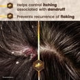 thumbnail image 4 of Tío Nacho Anti-Dandruff Shampoo with 2.2% Salicylic Acid & Royal Jelly, 14 fl oz (3 Pack), 4 of 9