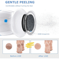 thumbnail image 4 of Electric Callus Remover for Feet,Electric Foot Grinder, Electric Callus Remover, 4 of 5