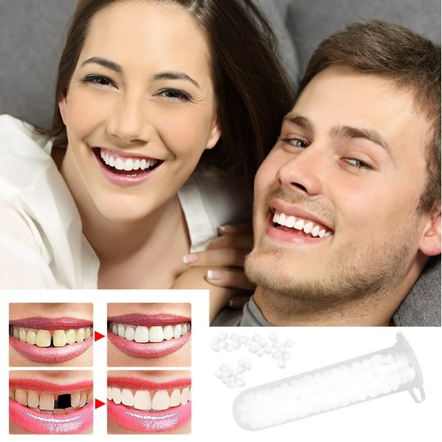 Xihbxyly En venta Granulos de restauración Kit de restauración Perlas de restauración temporal para dientes faltantes Dientes con perlas para una sonrisa segura