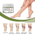 thumbnail image 2 of Varicose Vein Cream 50g Varicose Vein Cream Anti-spider And Vein Removal Varicose Leg Care, 2 of 5