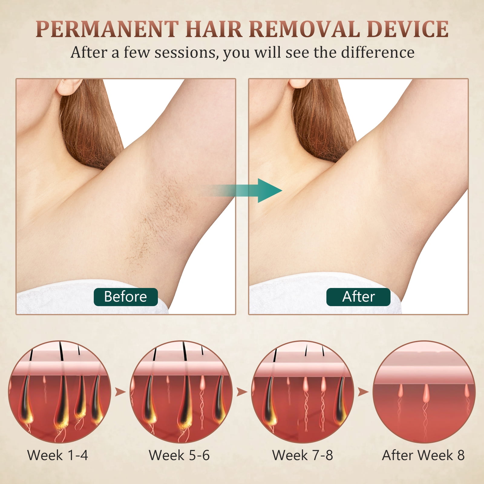 Yosemy IPL Hair Removal Device, IPL Laser Hair Removal Device