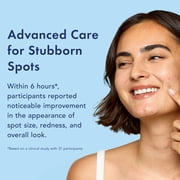Rael Miracle Patch Advanced Strength Retinol Spot Cover, for Stubborn Pimples, 24 Count