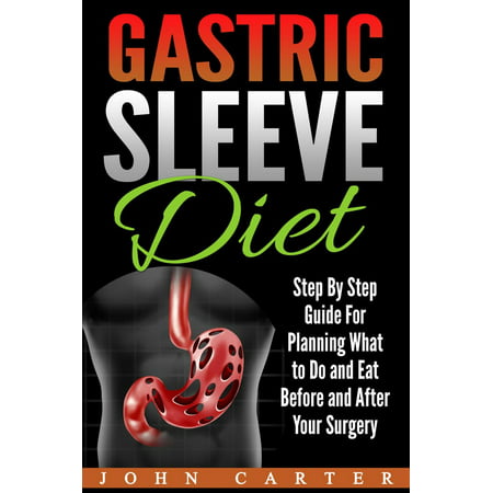 Gastric Sleeve Diet: Step By Step Guide For Planning What to Do and Eat Before and After Your Surgery -