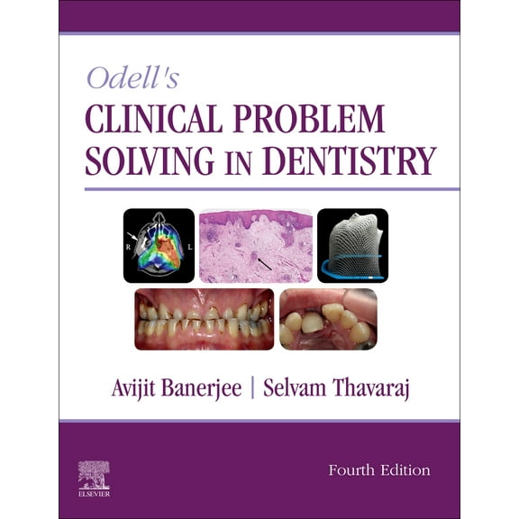 Odell's Clinical Problem Solving in Dentistry