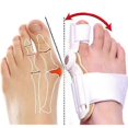 thumbnail image 1 of 2 Pack Bunion Corrector & Toe Straightener, Hallux Valgus Orthopedic Splint for Foot Pain Relief & Alignment, 1 of 2