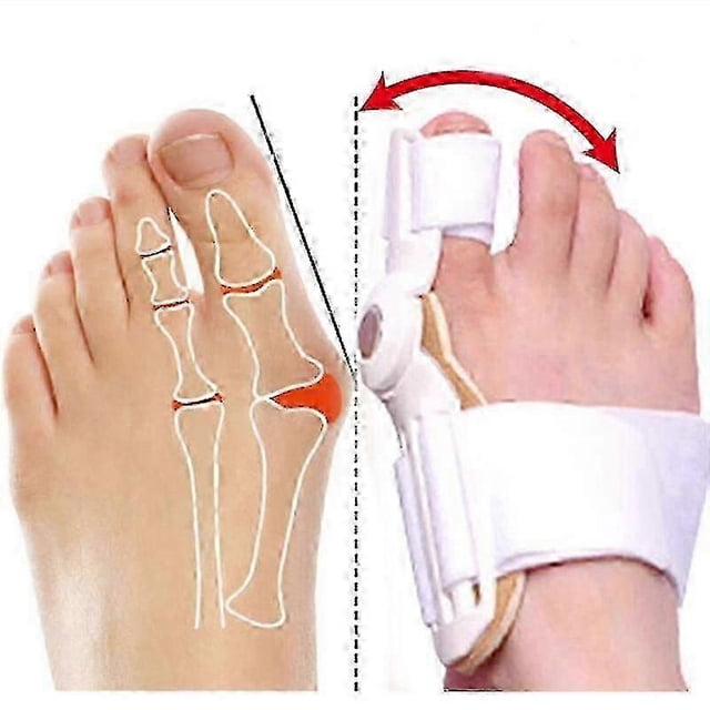 2 Pack Bunion Corrector & Toe Straightener, Hallux Valgus Orthopedic Splint for Foot Pain Relief & Alignment