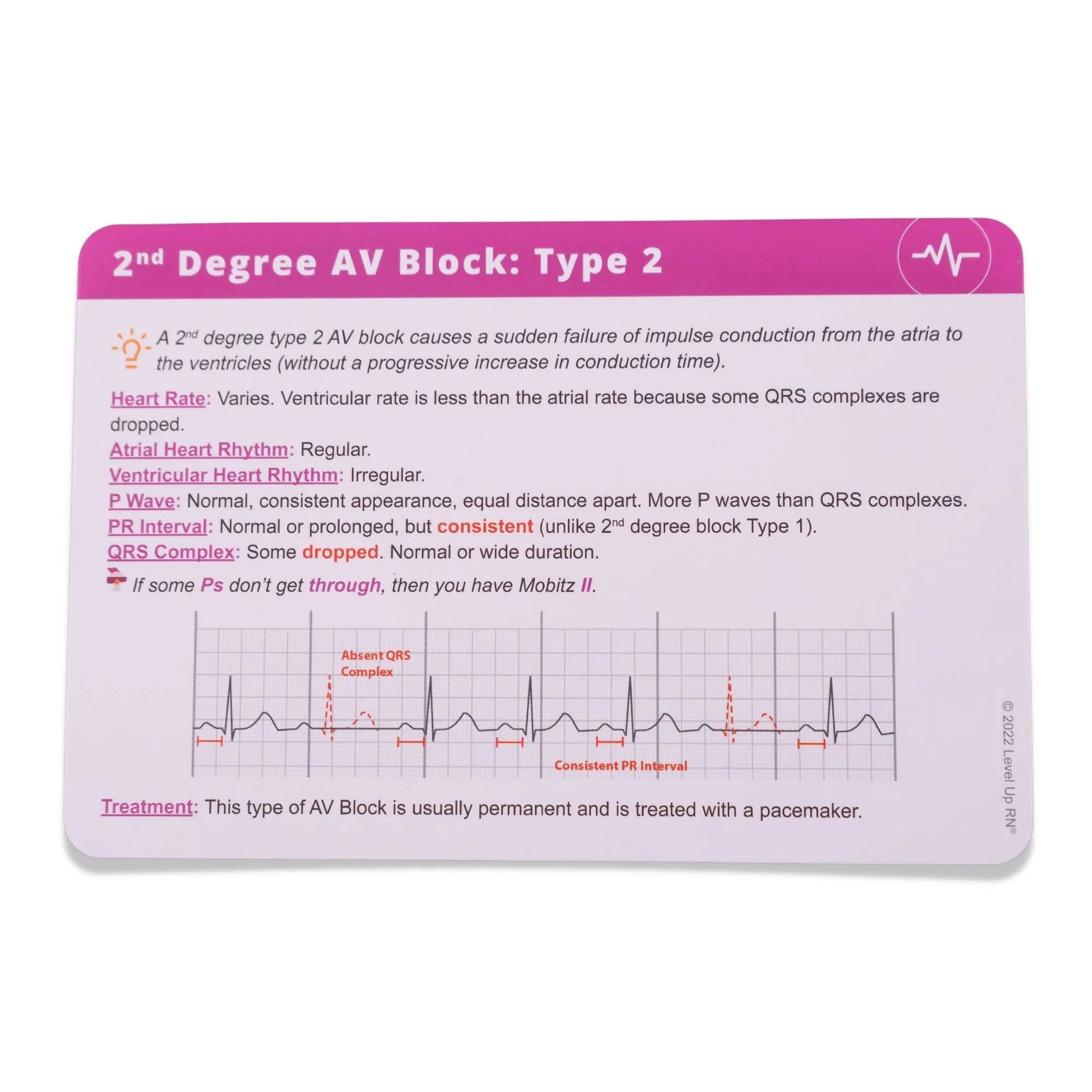 Level UP RN EKG Interpretation Flash Cards – for Nursing/EMT/Paramedic School (45 Cards)