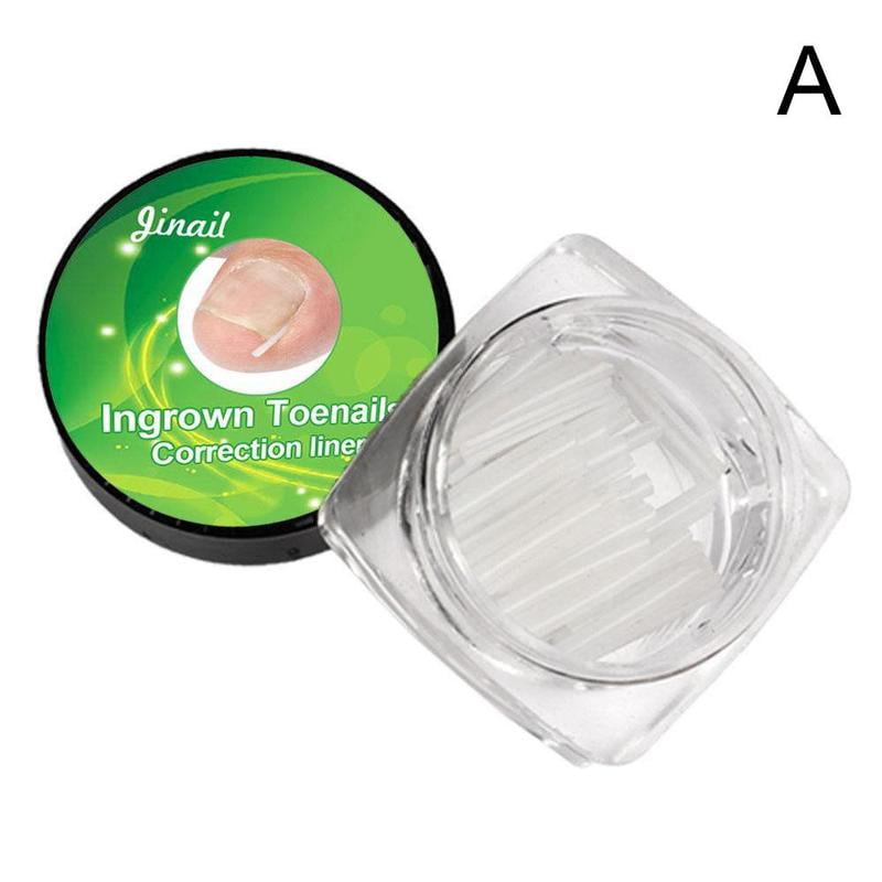 Ingrown Toenail Treatment Liner Ingrowing Toe Nail Correction Tools