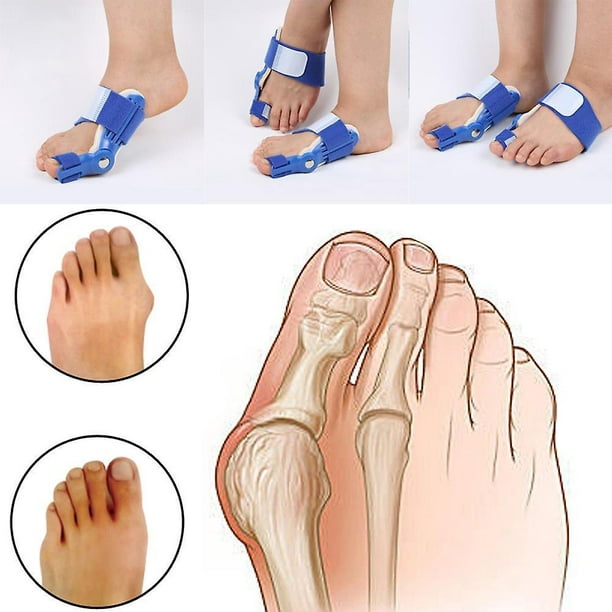 1 Pair Orthotics Braces Big Bone Toe Hallux Valgus Foot Pain Guard