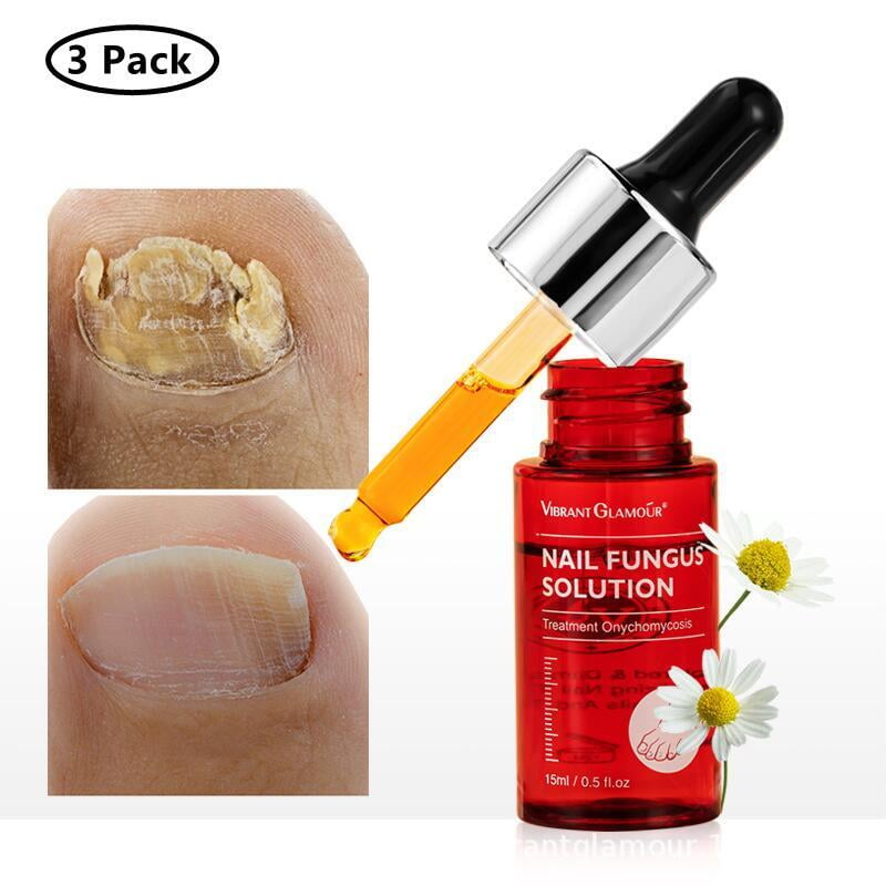 3 Pack Foot Cure Extra Strong Nail & Toe Nail Renewal - Nail Repair, Fix & Renew Damage Nail, Broken, Cracked & Discolored Nails