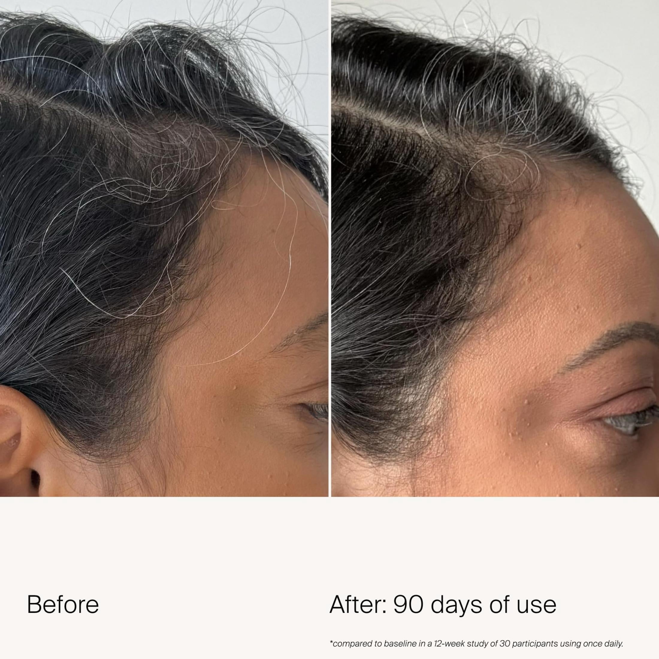 Living Proof Scalp Care Density Serum