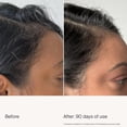 thumbnail image 3 of Living Proof Scalp Care Density Serum, 3 of 8