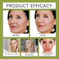 thumbnail image 5 of Retinol Shot Tightening Serum Professional Firming Treatment with Peptide Complex & Panthenol Anti-Aging Face Serum 30ml, 5 of 5