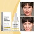 thumbnail image 4 of Esencia reafirmante y antiarrugas de 30 ml. Reduce eficazmente las arrugas., 4 of 4