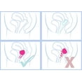 thumbnail image 4 of Merula Cup Strawberry (Pink) - The One-Size Menstrual Cup, 4 of 5