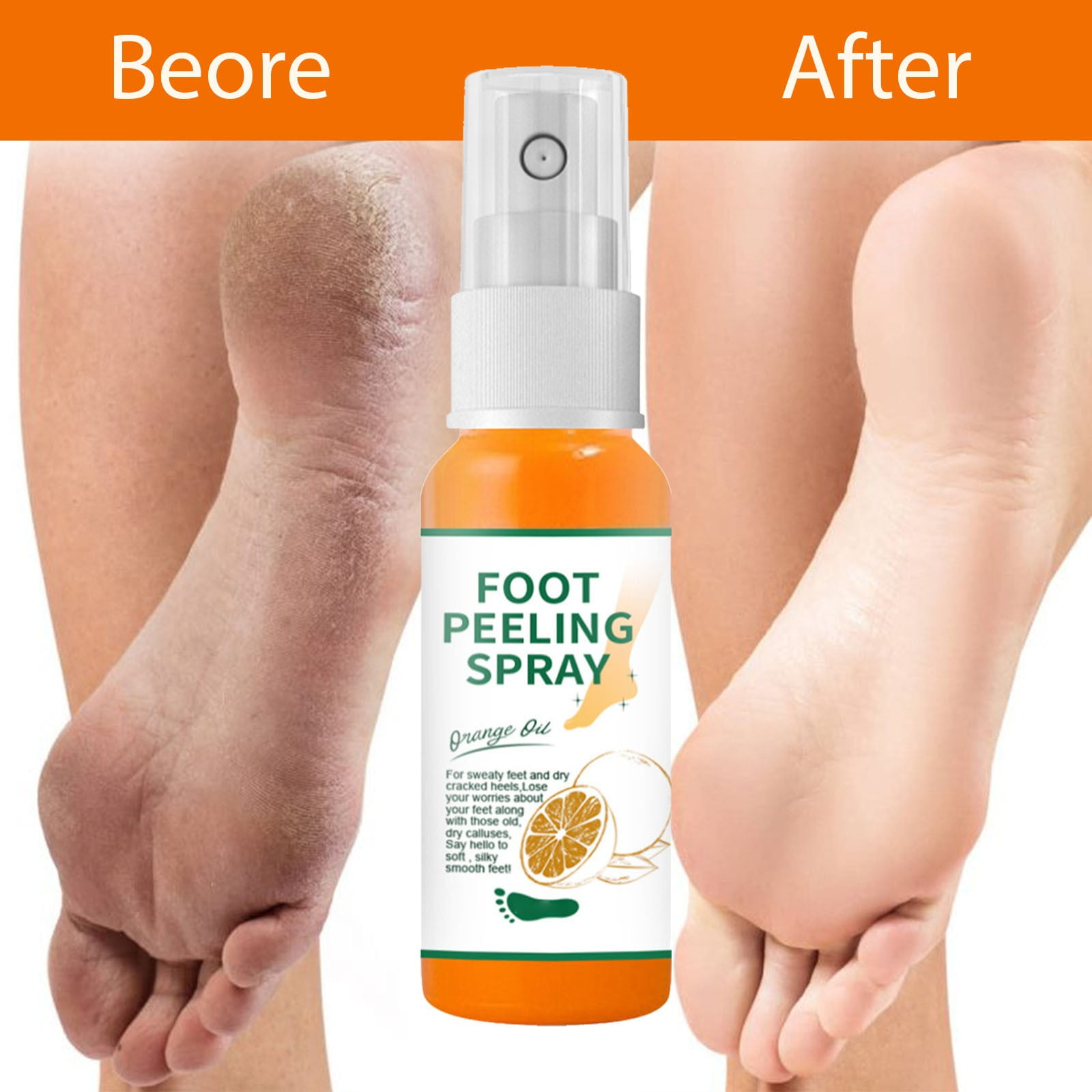 Callus Dead Skin Removal Spray Foot Heel Cracked Repair Exfoliating &  Moisturizing for Dryness Hand Feet Care 60ml