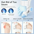 thumbnail image 5 of Bunion Corrector for Women & Men with Adjustable Knob Silicone Pad, Bunion Relief Big Toe Splint for Left/Right Feet, White, 5 of 10
