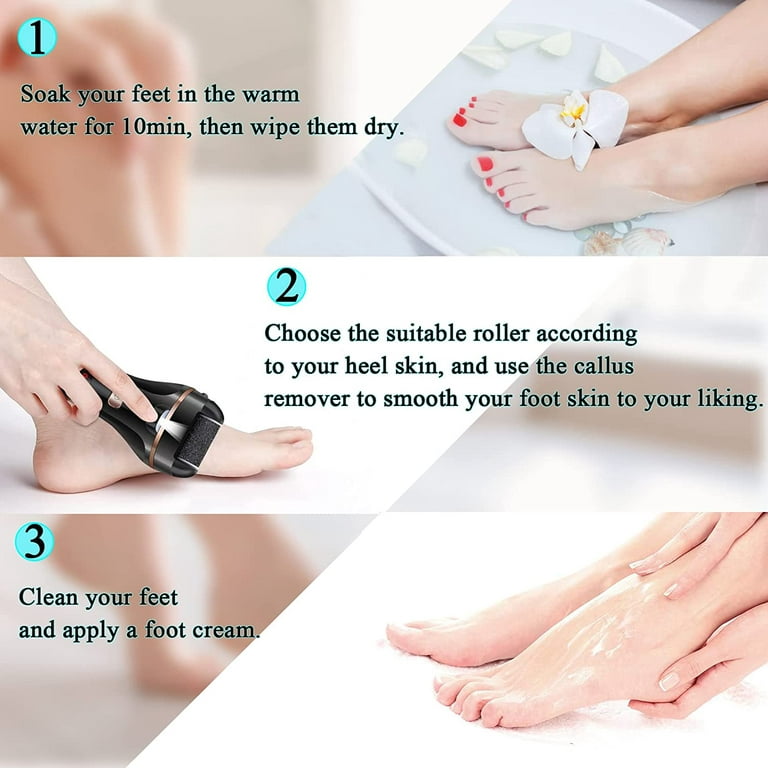  Double-sided Pedicure Tools, Dead Skin Callus Remover, Foot  File and Foot Rasp for Exfoliating Calluses, Foot Care and Grinding(01) :  Beauty & Personal Care