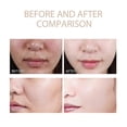 thumbnail image 2 of Gel exfoliante purificante Quarxery 1-3x, gel exfoliante Quarxery, exfoliante facial hidratante de limpieza profunda, gel exfoliante facial y corporal f 2 piezas, 2 of 5