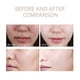 thumbnail image 2 of Gel exfoliante purificante Quarxery 1-3x, gel exfoliante Quarxery, exfoliante facial hidratante de limpieza profunda, gel exfoliante facial y corporal f 3 piezas, 2 of 4
