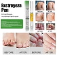 thumbnail image 4 of Líquido para uñas grises de manos y pies. Líquido para uñas grises. Líquido espesante y nutritivo para uñas grises, 5 ml, 4 of 8