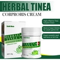 Herbal Tinea Corporis Cream Tinea Skin Relief Itching Cream, Gentle and